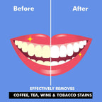 Perfora Teeth Whitening Powder