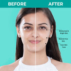 Nykaa SKINRX Spot Corrector with 10% Niacinamide + 1% Zinc Serum to Fade Dark Spots & Pigmentation
