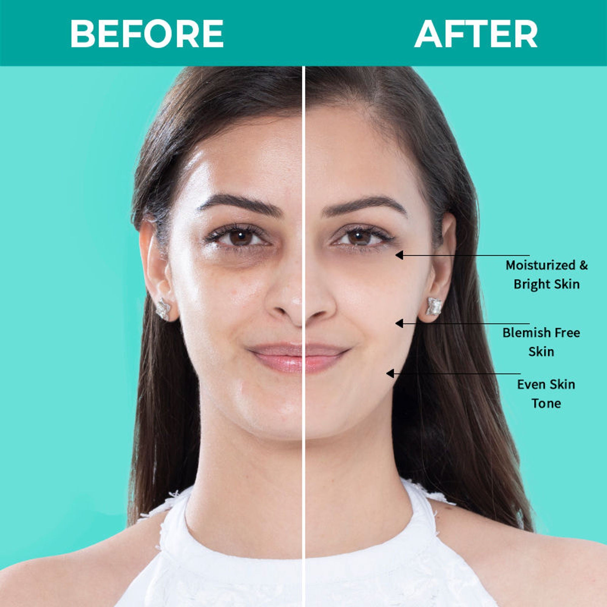 Nykaa SKINRX Spot Corrector with 10% Niacinamide + 1% Zinc Serum to Fade Dark Spots & Pigmentation