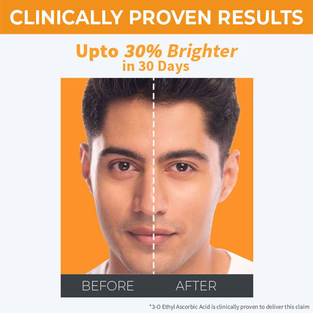 Nykaa SkinRX llluminate+ with 10% Vitamin C + 5% Niacinamide Serum for Bright, Radiant Skin Glow
