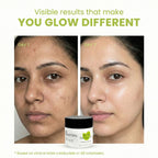 The Skin Story Moringa Face Pack For Deep Cleansing