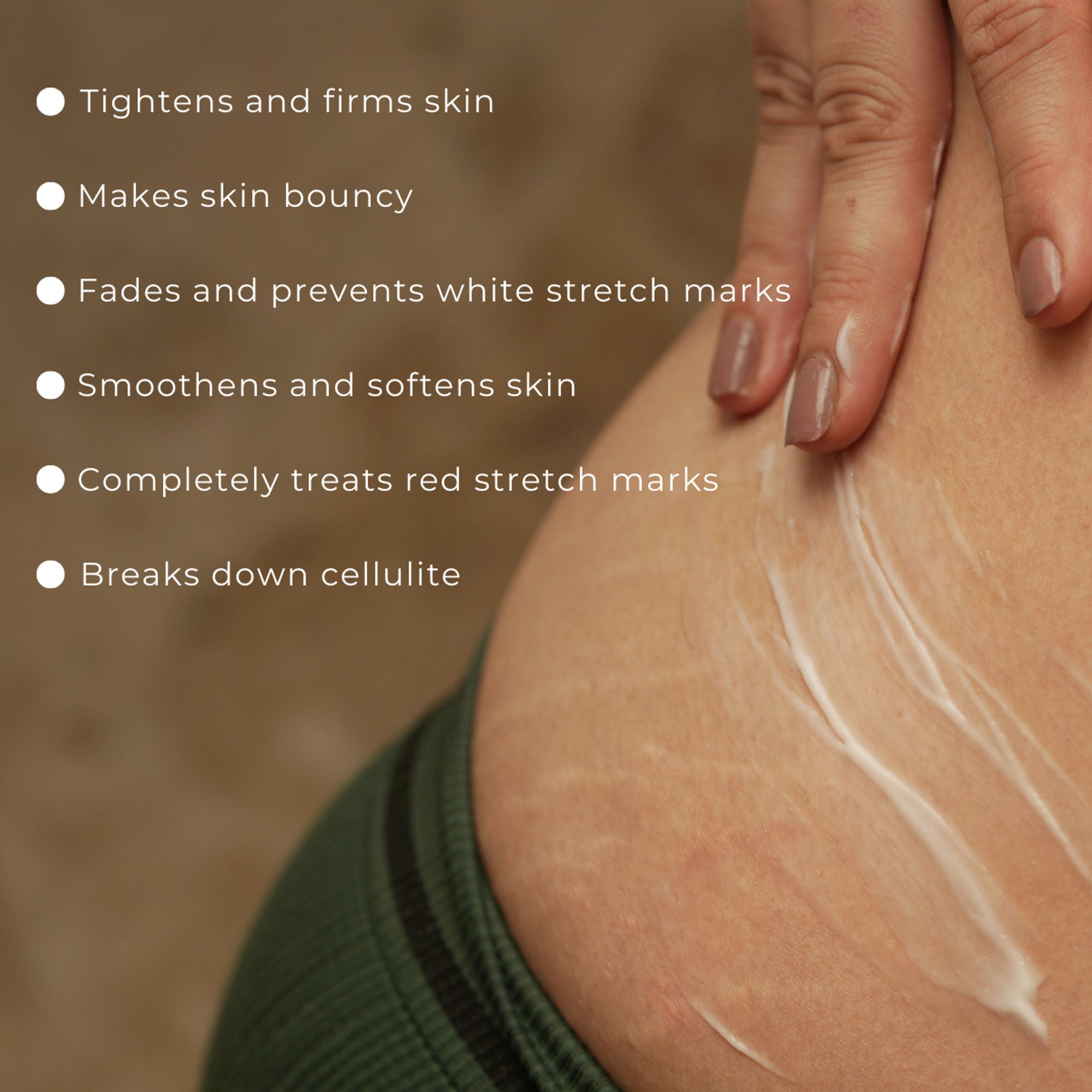 Skinvest Bomb bum cream for Stretch Marks + Cellulite