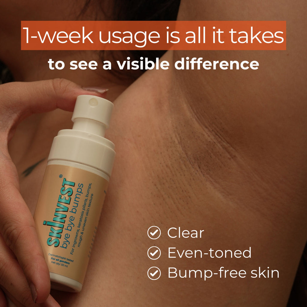 Skinvest Bye Bye Bumps - Exfoliating Body Mist
