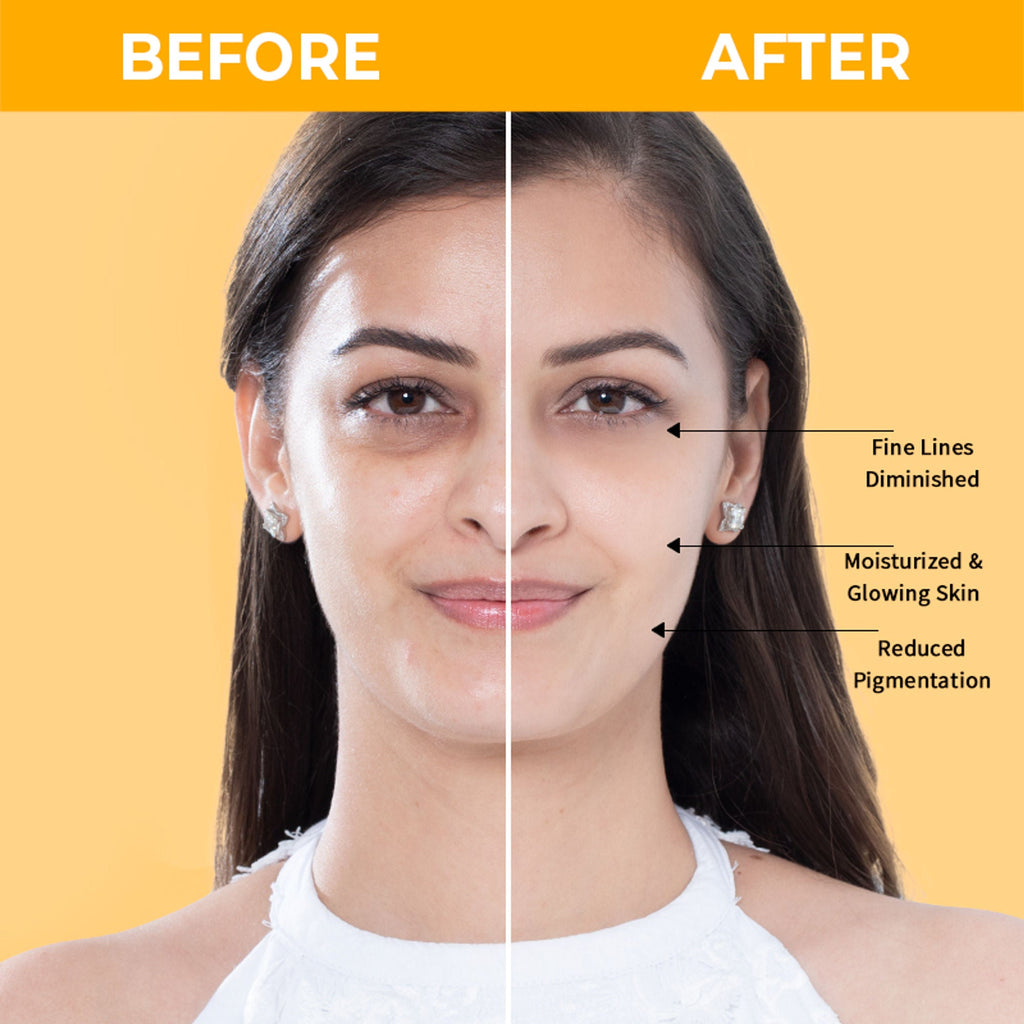 Nykaa SkinRX Illuminate+ Vitamin C Day Moisturizer SPF 15 for Radiant, Hydrated Normal to Dry Skin