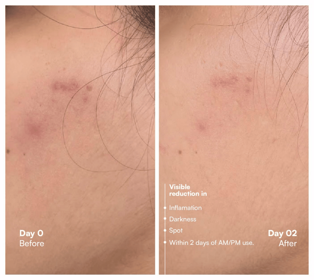 Awear Beauty Glass Skin Dual Spot Treatment