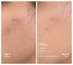 Awear Beauty Glass Skin Dual Spot Treatment