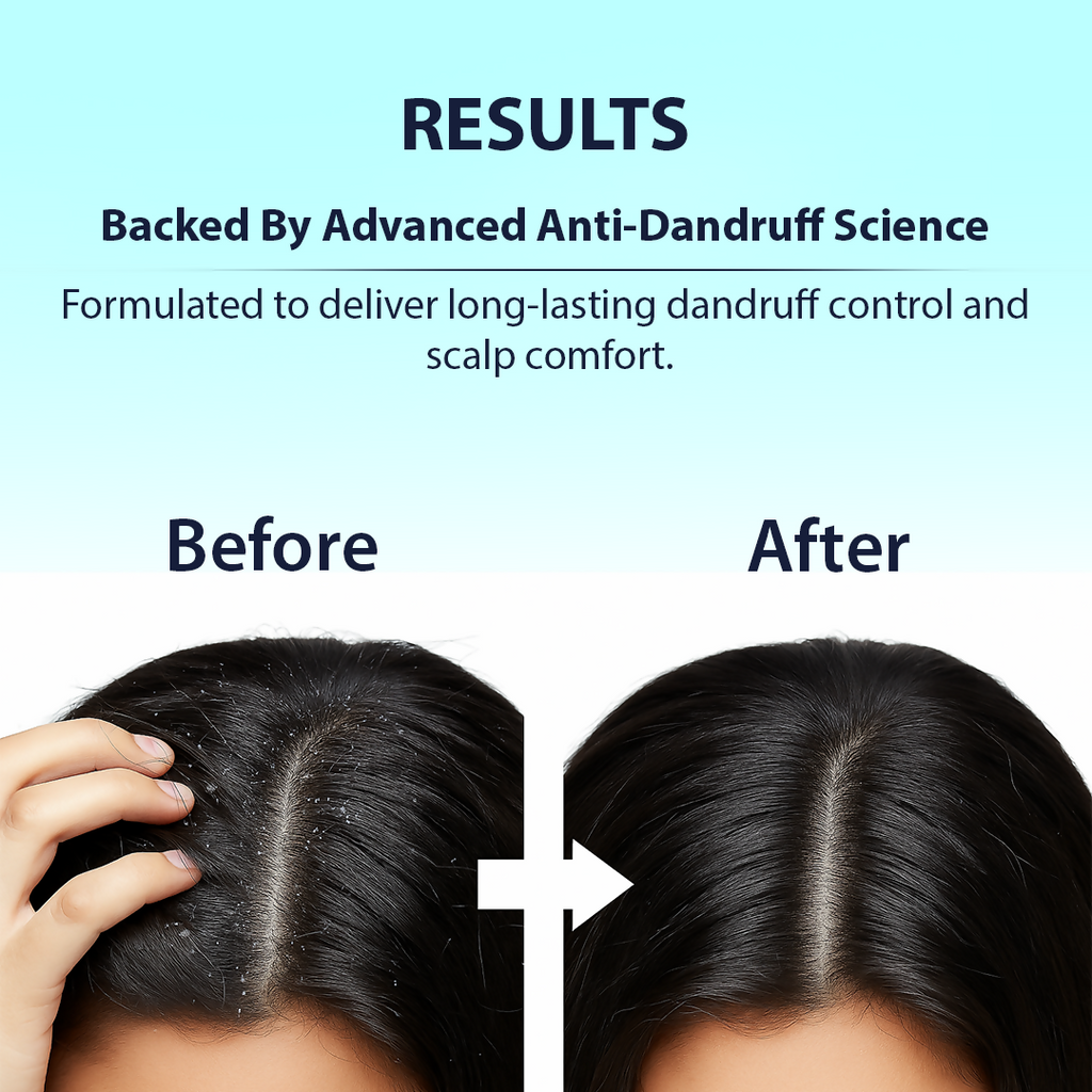 Dermistry Anti-Dandruff Control Hair Mask - Distacart