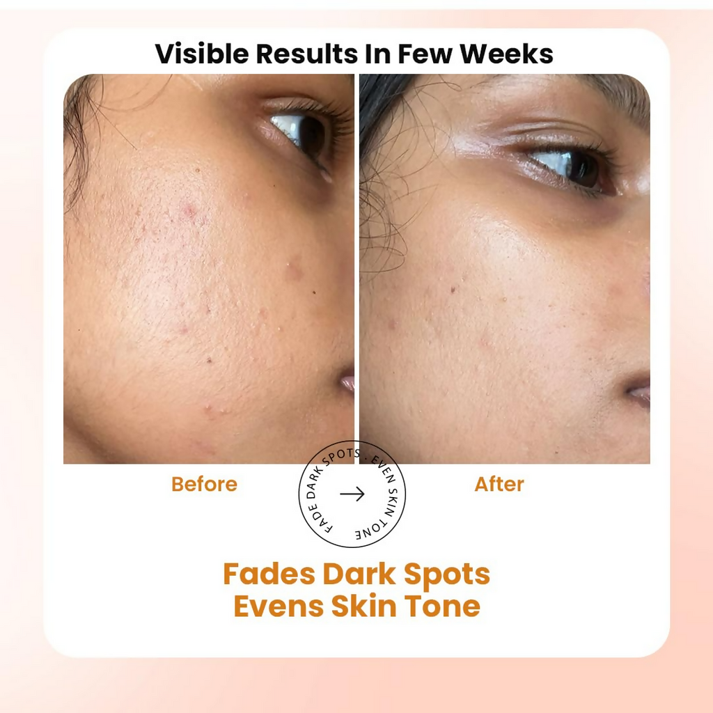 Truth & Beauty Vitamin C Face Serum