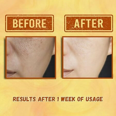 Our Cares Vitamin C Face Cream for Glowing & Clear Skin - Distacart