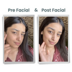 Alps Goodness Diamond Hydrating Facial Kit
