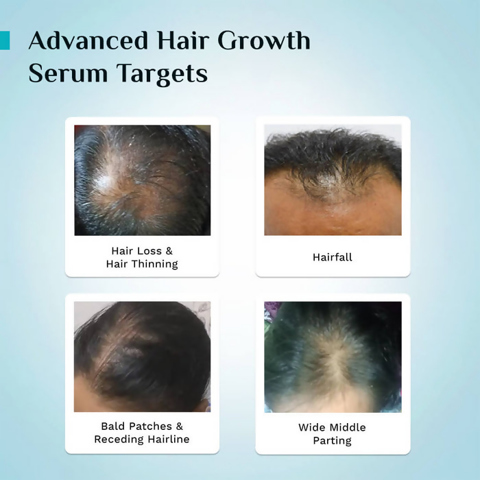 Pilgrim 3% Redensyl, 4% Anagain & 5% Capilia Stem Cell Complex Advanced Hair Growth Serum Roll-On - Distacart