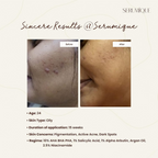 Serumique 23% AHA + 2% BHA + 5% PHA Wash-Off Serum Exfoliator - New You 30%