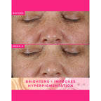 Farmacy Beauty Brighten Up 3% TXA Dark Spot Toner
