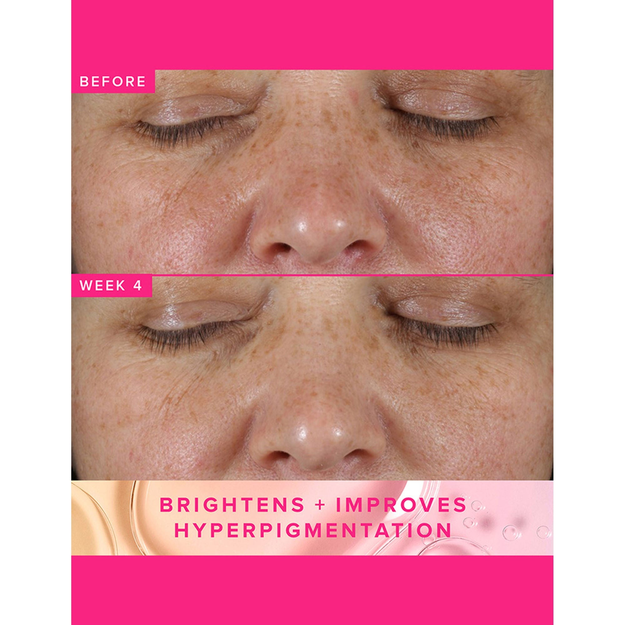 Farmacy Beauty Brighten Up 3% TXA Dark Spot Toner