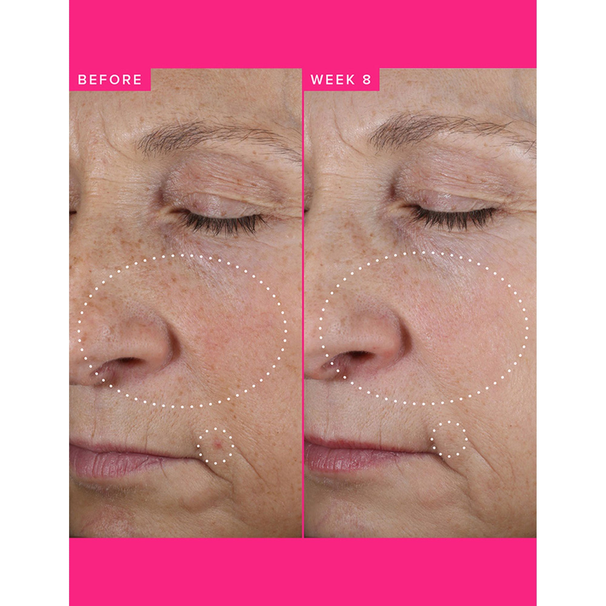 Farmacy Beauty Brighten Up 3% TXA Dark Spot Toner
