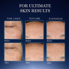Lancome Genifique Ultimate Skin Repair Serum With Beta Glucan