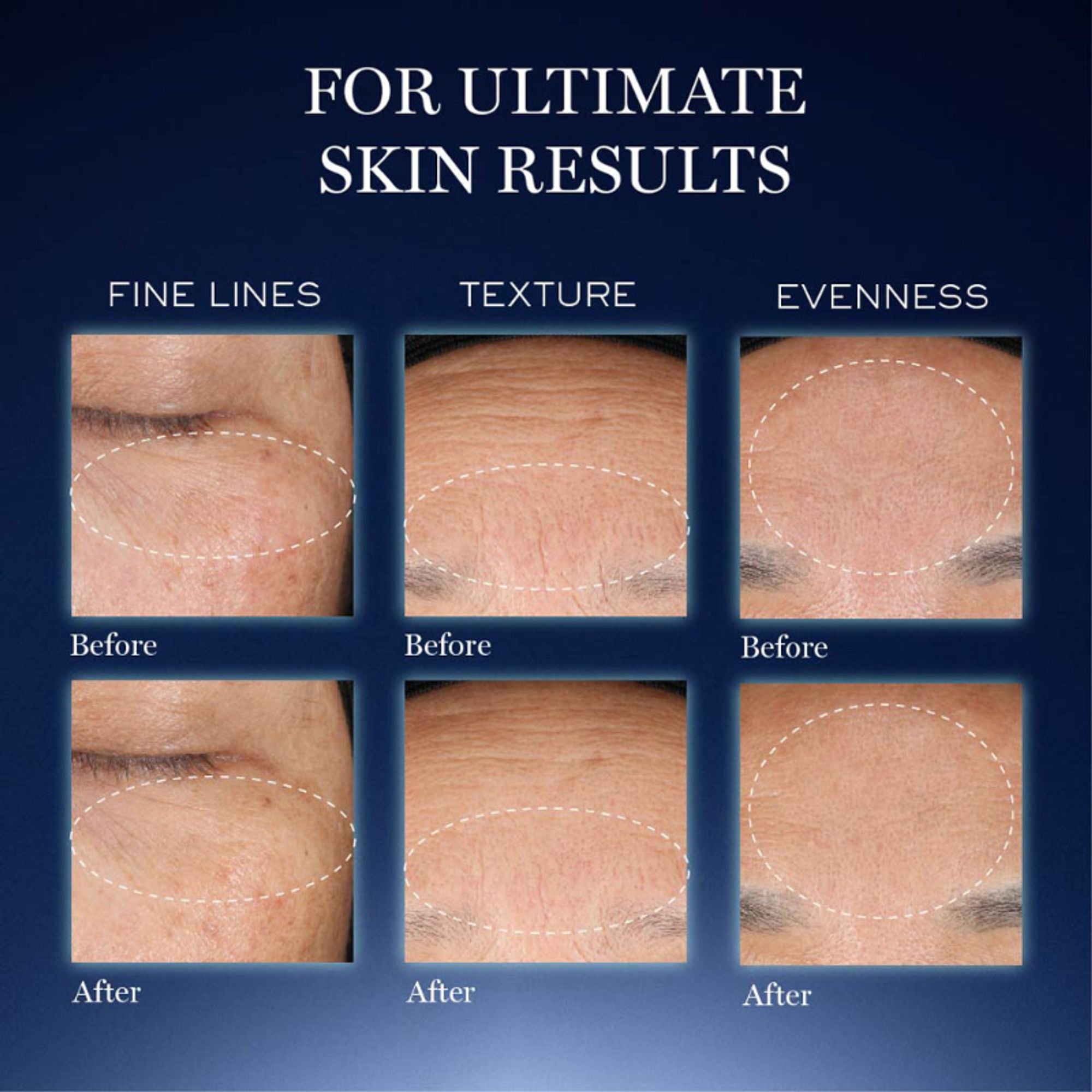 Lancome Genifique Ultimate Skin Repair Serum With Beta Glucan