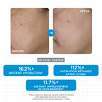 SkinQ Moisture Balm