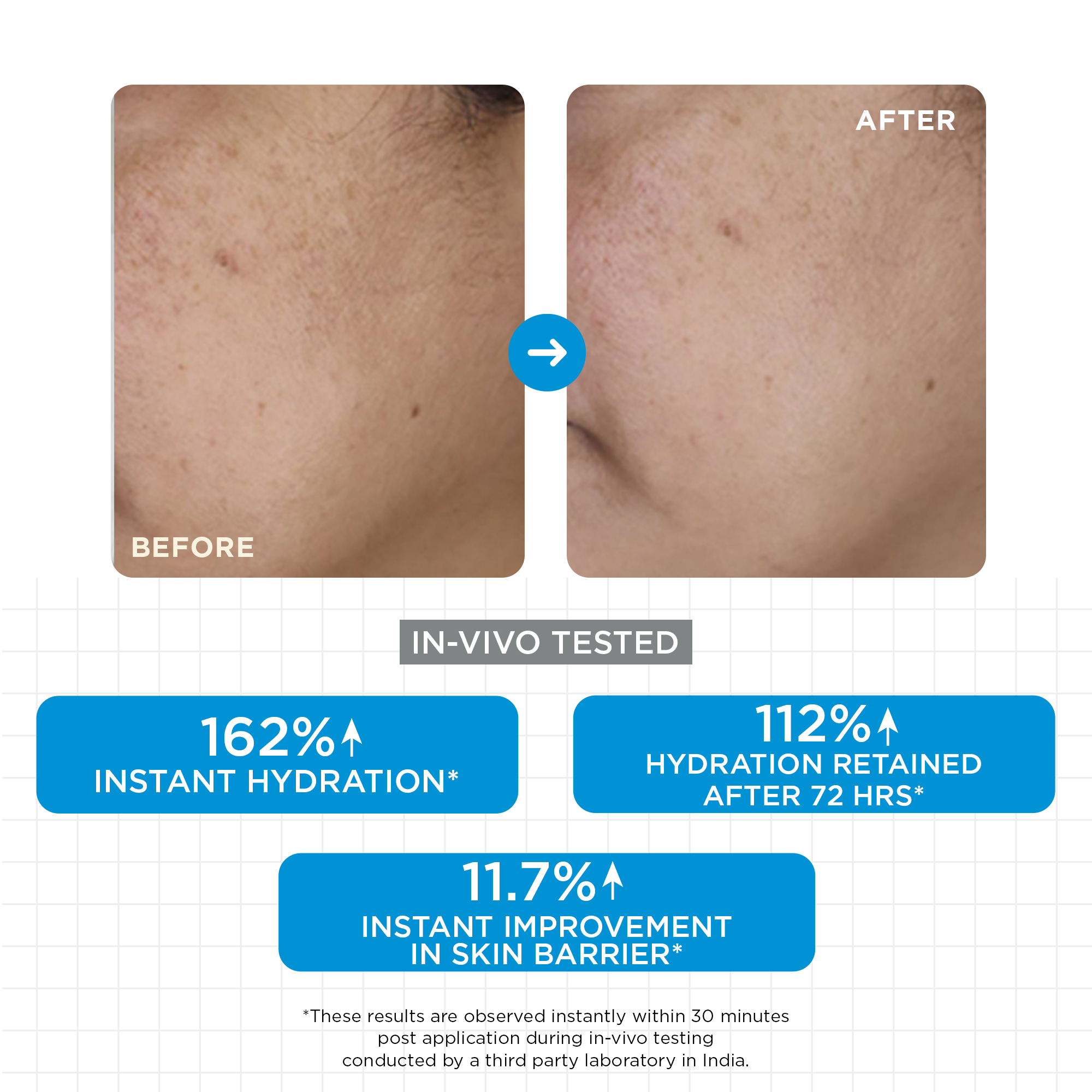 SkinQ Moisture Balm