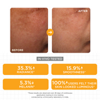 SkinQ Brightening Serum with Kojic, Lactic & Malic Acid