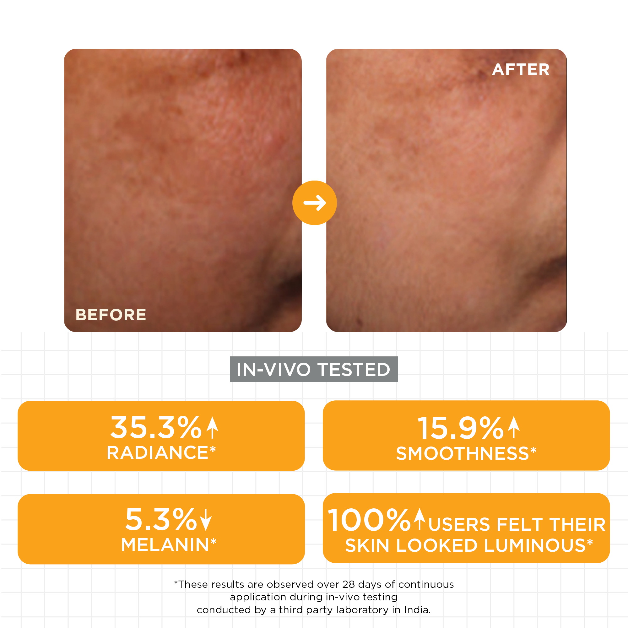 SkinQ Brightening Serum with Kojic, Lactic & Malic Acid