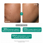 SkinQ Acne & Oil Control Serum