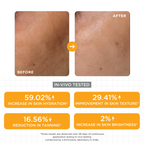 SKINQ 15% Vitamin C Glow Serum with L Ascorbic & Ferulic Acid