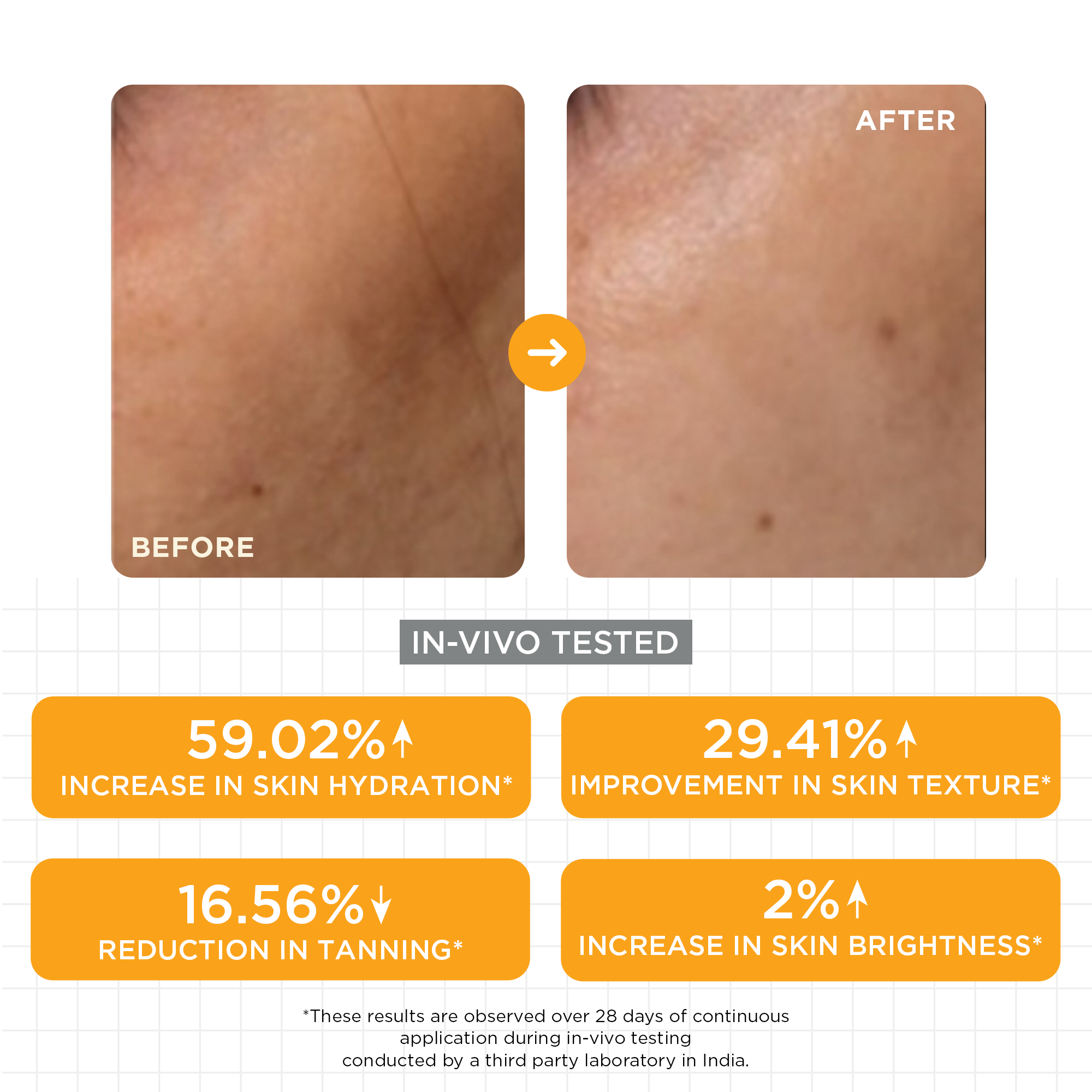 SKINQ 15% Vitamin C Glow Serum with L Ascorbic & Ferulic Acid