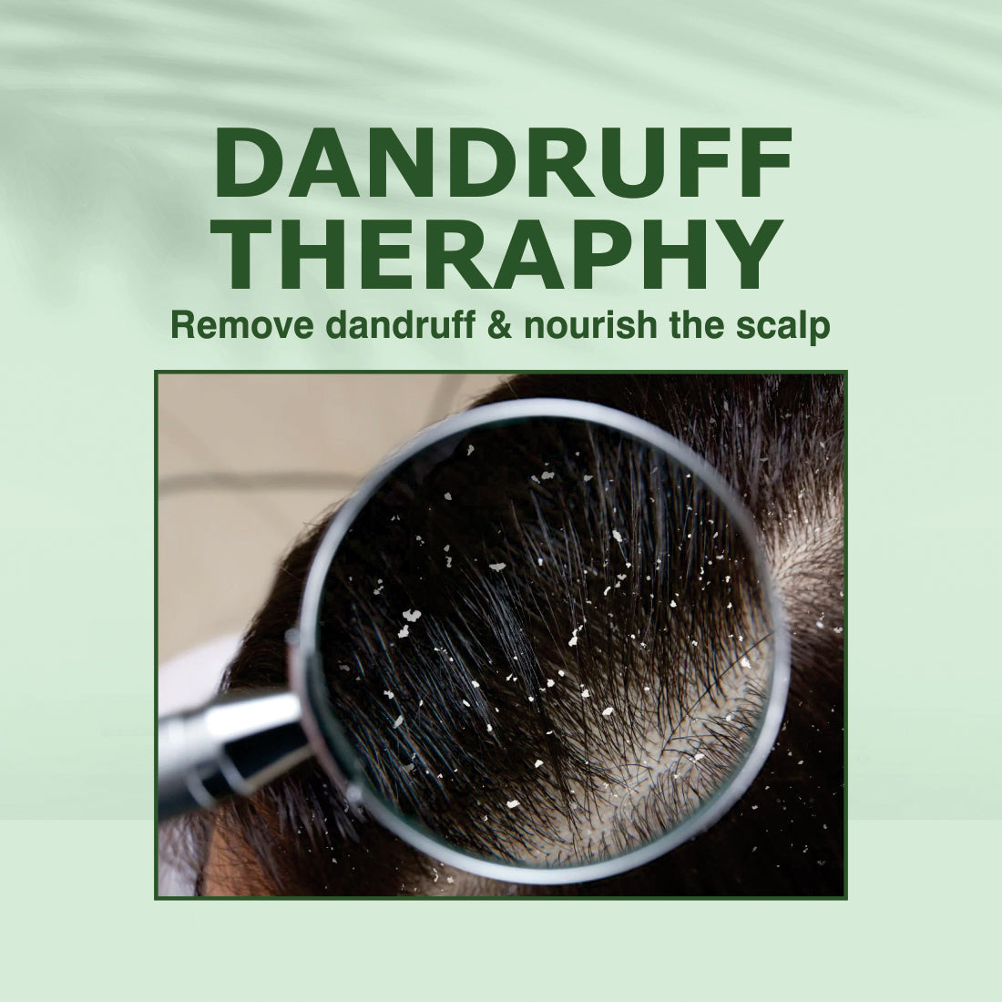 Nuerma Science Anti-Dandruff Hair Oil | Dandruff Relief & Scalp Rejuvenation