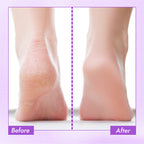 Nykaa Skin Happy Heels 20%Urea, 2%Lactic Acid Foot Cream-Dry & Cracked Feet - Lavender & Peppermint - Distacart