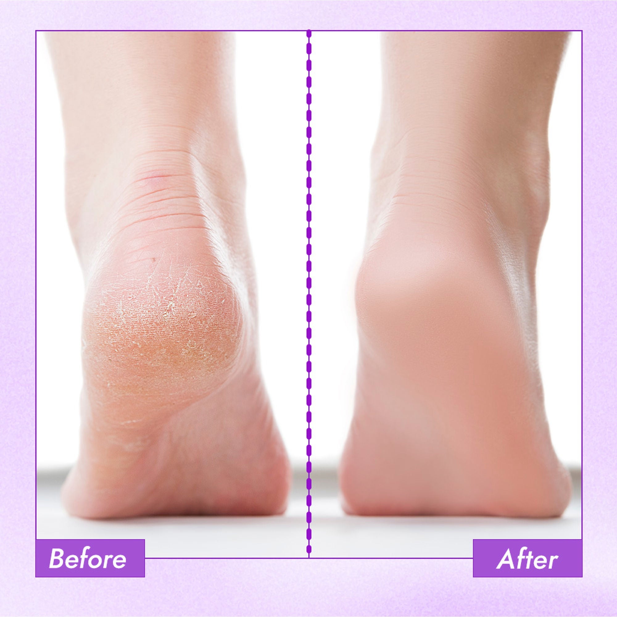 Nykaa Skin Happy Heels 20%Urea, 2%Lactic Acid Foot Cream-Dry & Cracked Feet - Lavender & Peppermint - Distacart