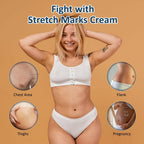 7 Days Stretch Marks Cream Oil packaging detail