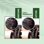 Nuerma Science Anti-Dandruff Hair Oil | Dandruff Relief & Scalp Rejuvenation