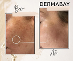 Dermabay Skin Brightening Face Serum With Kojic Acid & Alpha Arbutin