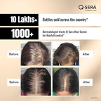QSERA Hair Serum for Hair Fall Control - Distacart