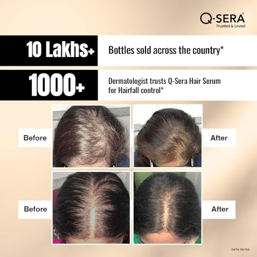 QSERA Hair Serum for Hair Fall Control - Distacart