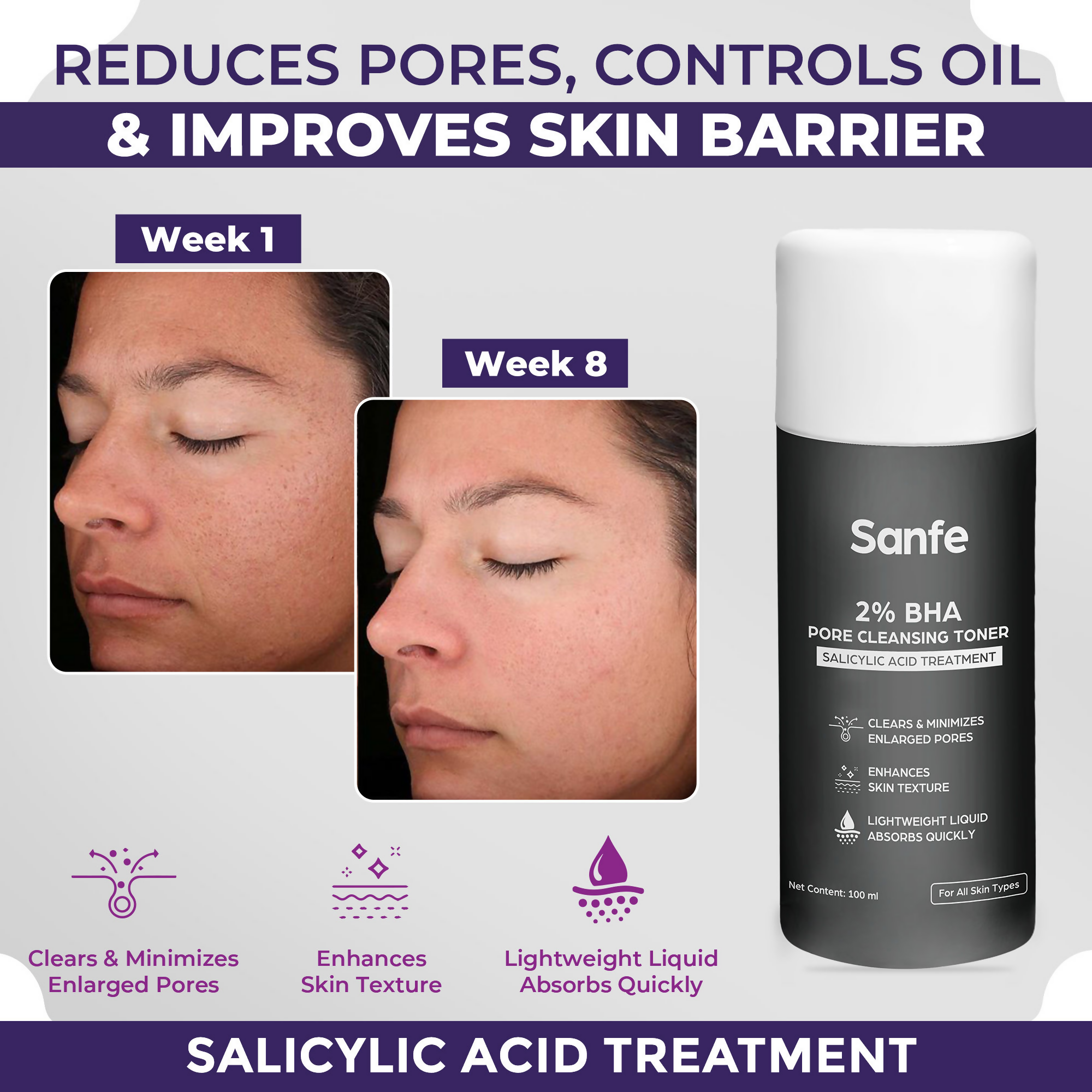 Sanfe 2% BHA Pore Cleansing Toner
