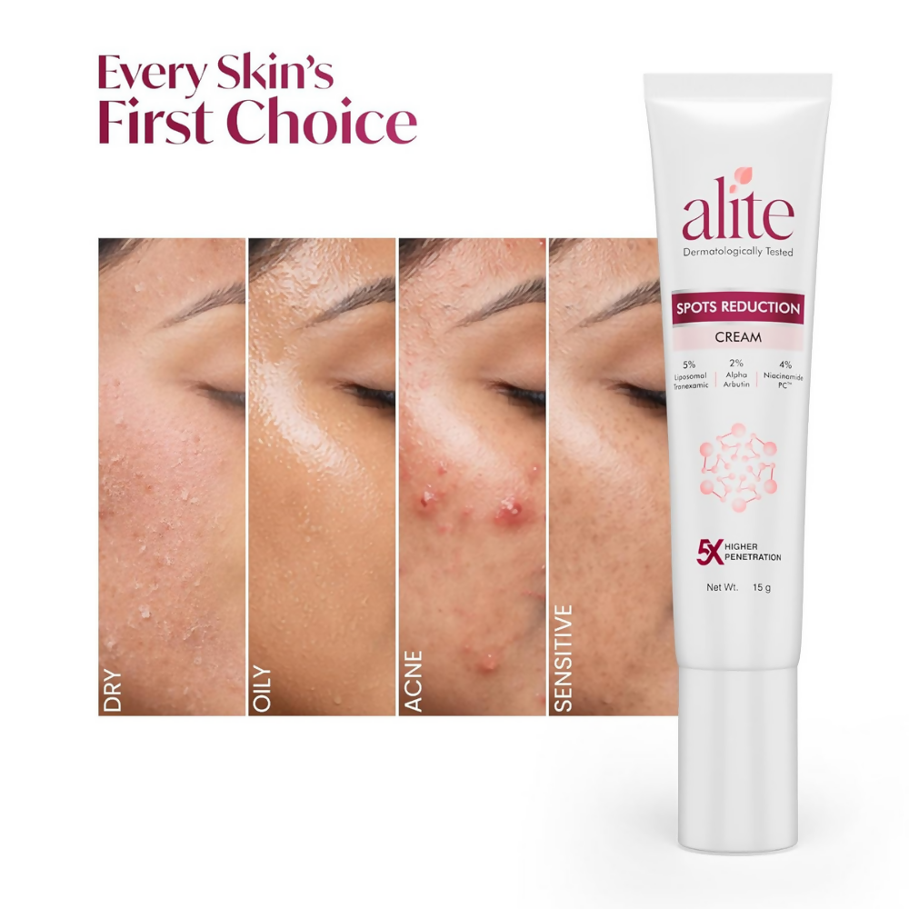Alite Spots Reduction Cream with 5X Enhanced Absorption - Distacart