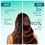 Careberry 100% Organic Rosemary & Jojoba Anti Dandruff Hair Oil