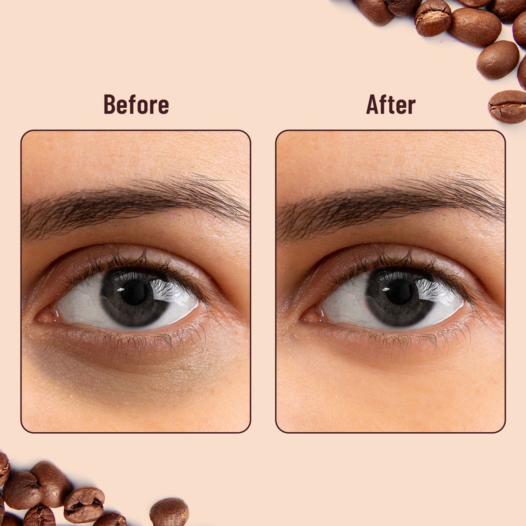 Swiss Beauty Hydra Eye Serum Patches For Dark Circles And Puffiness , Hydrate Skin - Coffee - Distacart