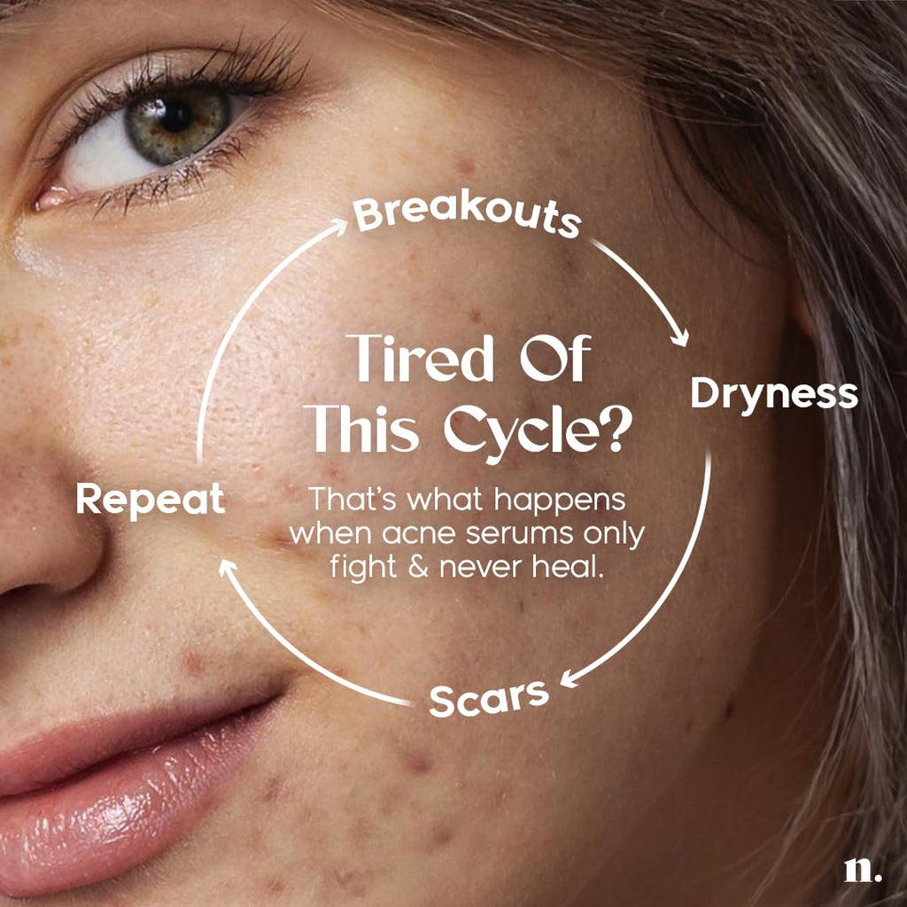 Numour No Breakouts Tonight Acne Control Barrier Repair Dual Serum