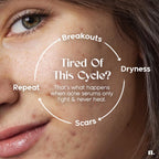 Numour No Breakouts Tonight Acne Control Barrier Repair Dual Serum