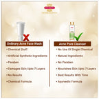 Inveda Teen's Care Acne Pore Cleanser