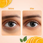 Swiss Beauty Hydra Eye Serum Patches For Dark Circles And Puffiness , Hydrate Skin - Vitamin-C - Distacart