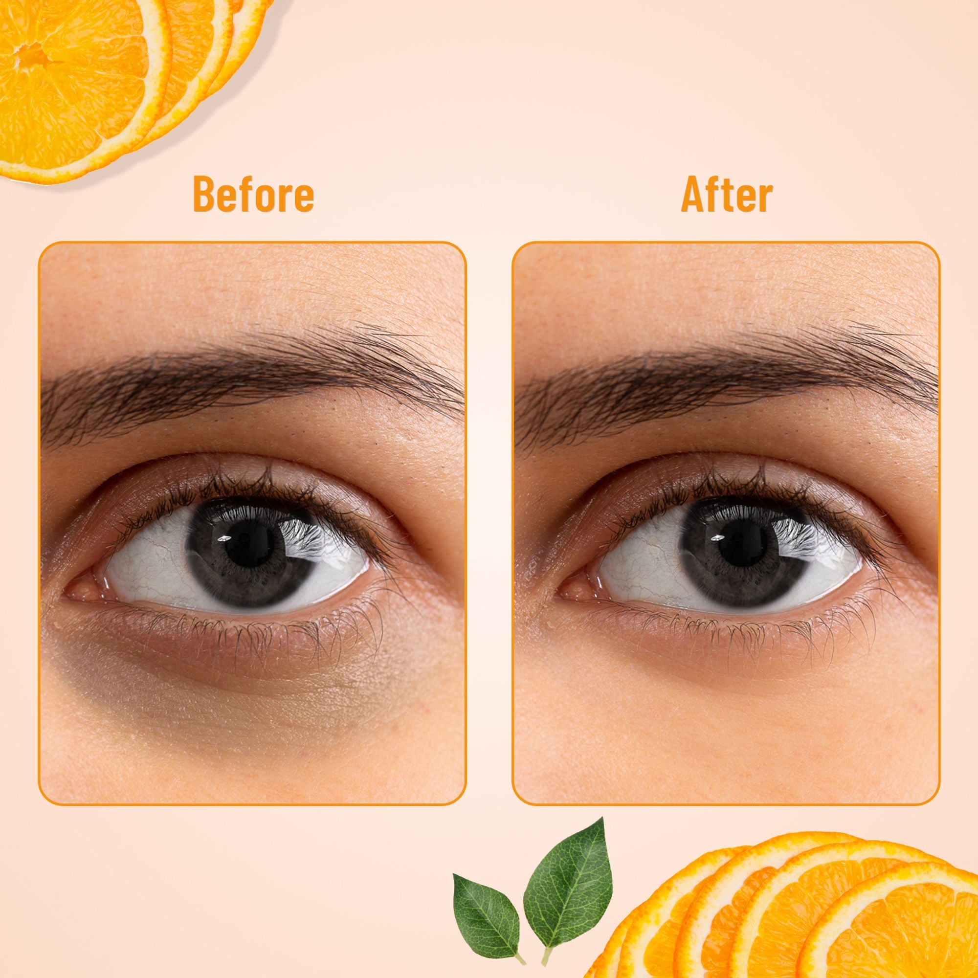 Swiss Beauty Hydra Eye Serum Patches For Dark Circles And Puffiness , Hydrate Skin - Vitamin-C - Distacart