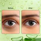 Swiss Beauty Hydra Eye Serum Patches For Dark Circles And Puffiness , Hydrate Skin - Alove Vera - Distacart