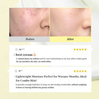 Dr.Althea 345 Relief Cream: Soothing & Barrier Repair Cream with power of Niacinamide & Panthenol