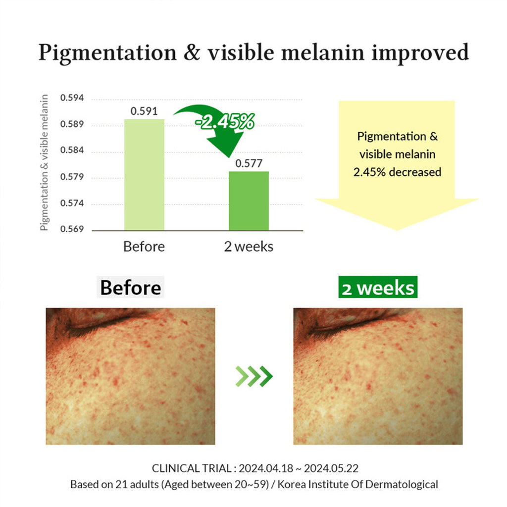 Dr.Althea Gentle Vitamin C Serum: Low-Irritation Brightening Serum for Sensitive Skin