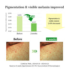 Dr.Althea Gentle Vitamin C Serum: Low-Irritation Brightening Serum for Sensitive Skin