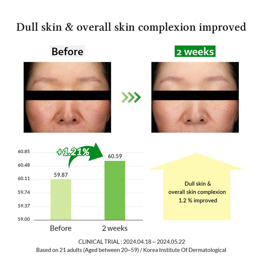 Dr.Althea Gentle Vitamin C Serum: Low-Irritation Brightening Serum for Sensitive Skin